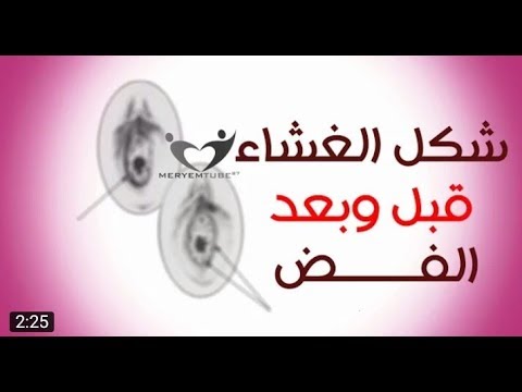 كيف افحص عذريتي في المنزل - طريقه لمعرفه انتى عذراء ام لا 3929 1