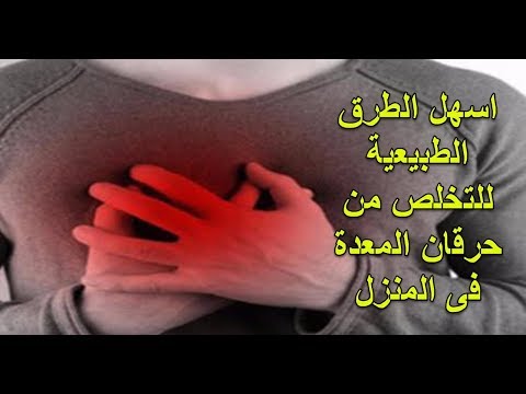 ماهو علاج حرقان المعده - تخلص من حرقان المعدة المزعج 3395 4