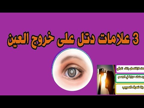 اعراض بعد الرقية الشرعية - كيف تعرف انك مسحور 666 2