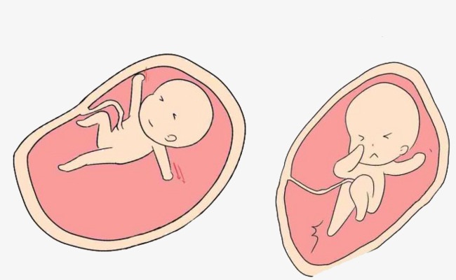 اسباب حركة الجنين الزائدة - حركة الجنين الزائدة وماذا تعنى