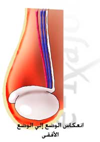 الم في الخصية اليمنى , اسباب الالام في الخصيتين